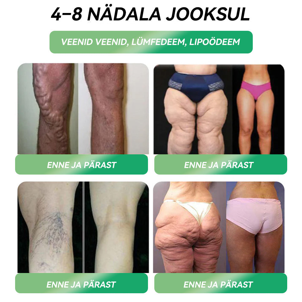 Tartu Ülikooli Kliinikumi soovitused |ametlik pood | 💗💯𝐒𝐓𝐃𝐄𝐈® 𝐆𝐋𝐏-𝟏 𝐊𝐚𝐚𝐥𝐮𝐥𝐚𝐧𝐠𝐮𝐬 𝐒𝐮𝐮𝐤𝐚𝐮𝐝𝐧𝐞 𝐥𝐚𝐡𝐮𝐬- 👨‍⚕️ Rasvumine, südame-veresoonkonna haigused, diabeet, uneapnoe, liigeseprobleemid ja palju muud